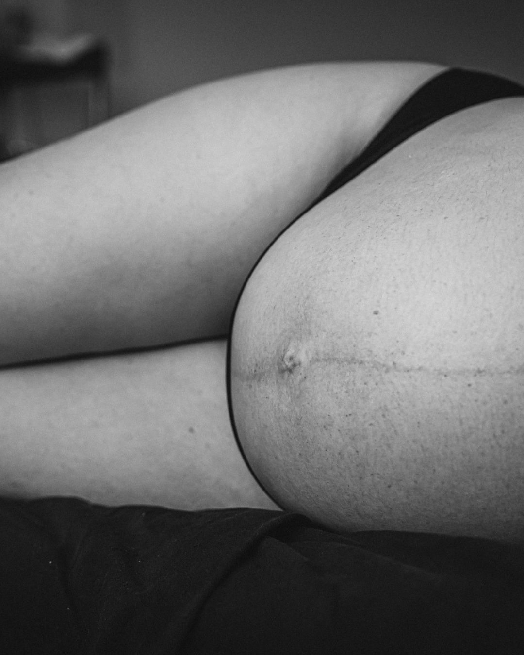 Detalle en blanco y negro de la panza en trabajo de parto