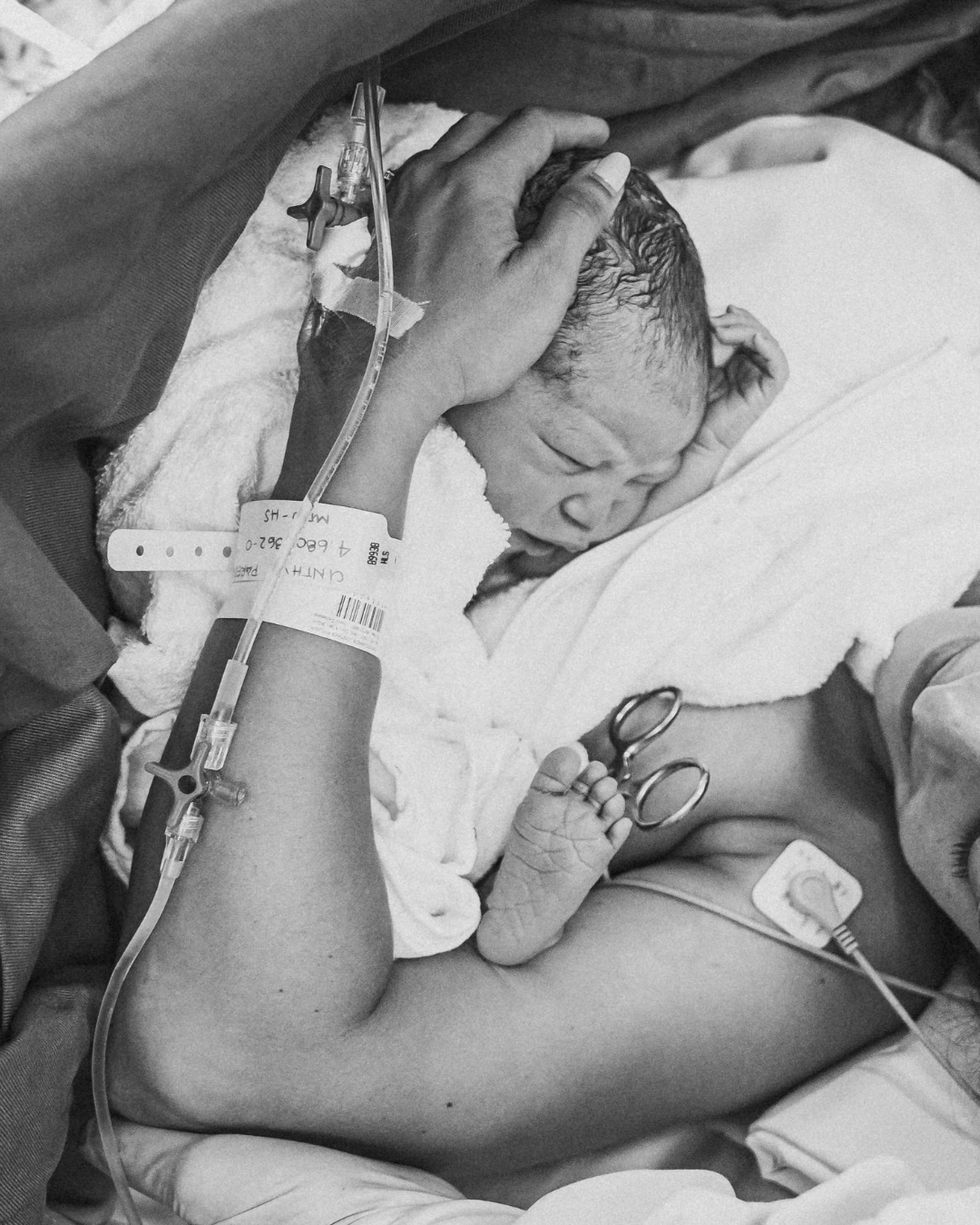 Recién nacido sobre el pecho de su mamá minutos después de nacer, en blanco y negro